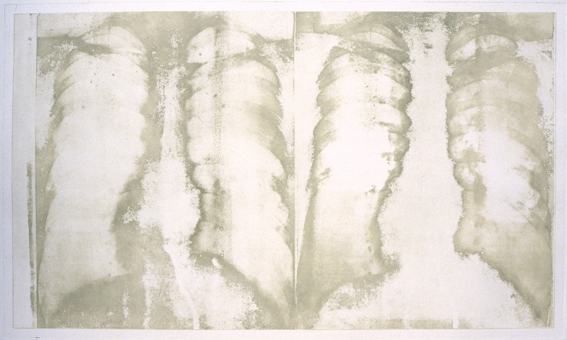 レントゲン｜白いレントゲンNo.1